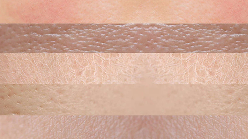 Understanding Men’s Skin Differences | SPF 50 Care